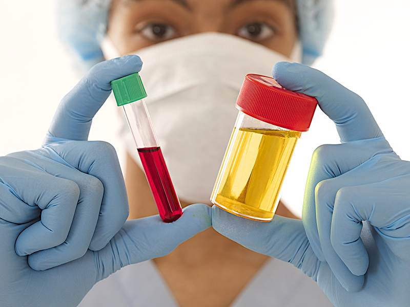 Laboratório de Análises Clínicas e Ensino em Saúde (LACES), ligado ao Instituto de Ciências Biológicas e ao curso de Biomedicina (ICB) da UFG oferece exames clínicos a preços populares | Foto: Ilustrativa