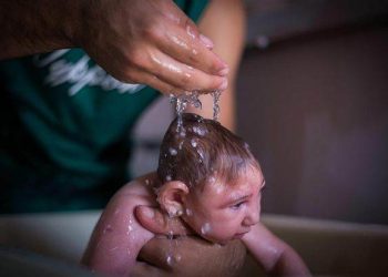 Microcefalia em Goiás já foi confirmada em 9 casos (Foto: EPA)