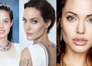 Angelina Jolie, Victoria Beckham, Kim Kardashian e Megan Fox passaram pela bichectomia (Foto: Reprodução)