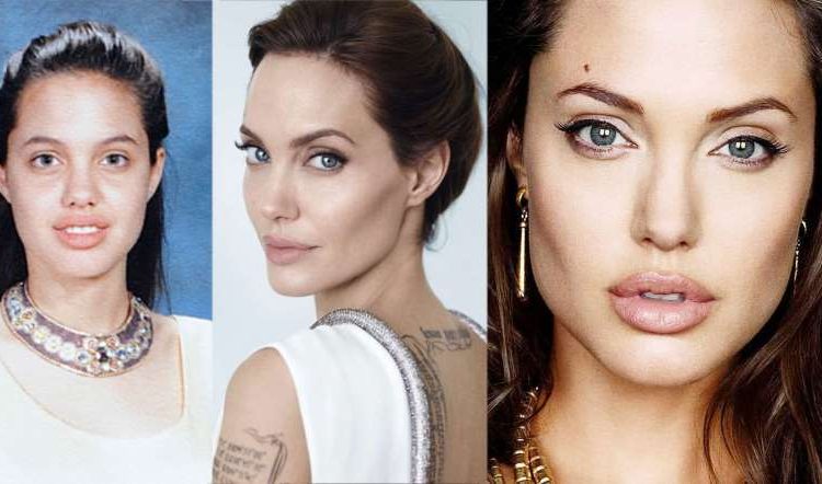 Angelina Jolie, Victoria Beckham, Kim Kardashian e Megan Fox passaram pela bichectomia (Foto: Reprodução)