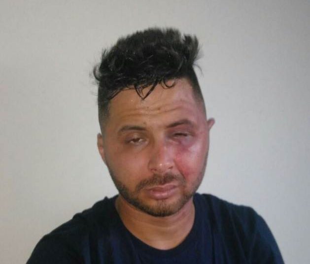 Johnathan Richard dos Santos Ramos, de 24 anos, é suspeito de cometer estupro em Goiânia | Foto: Divulgação/PM
