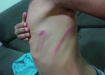 Criança de 11 anos teria sido torturada pelo irmão por mais de um ano em Goiânia | Foto: Reprodução