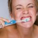 Dentista explica o jeito mais certo de escovar os dentes | Foto: Reprodução