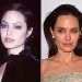 Pretende fazer uma bichectomia em Goiânia? Saiba tudo sobre a cirurgia pela qual a atriz Angelina Jolie já passou | Foto: Reprodução