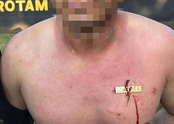 BBC repercute aluno de curso da Rotam que teve brasão cravado no peito | Foto: Reprodução/BBC