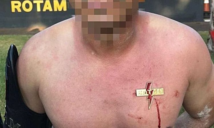 BBC repercute aluno de curso da Rotam que teve brasão cravado no peito | Foto: Reprodução/BBC