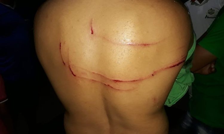 Homem é atacado por jacaré no Rio Araguaia, em Luiz Alves | Foto: Leitor / Whatsapp