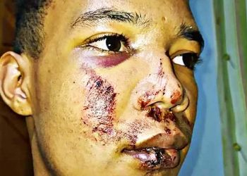 Jovem é espancado e perde grande parte dos dentes em Goiânia | Foto: Reprodução