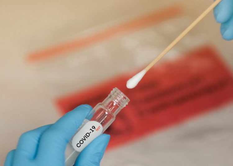 Teste para novo coronavírus - Crédito: Horth Rasur/ Shutterstock