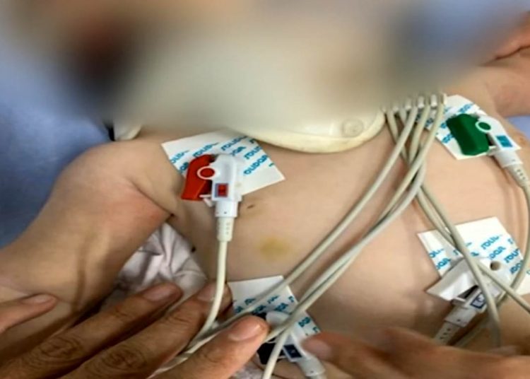 Bebê é intubado com hematomas e pais não sabem explicar como ocorreu | Foto: Divulgação
