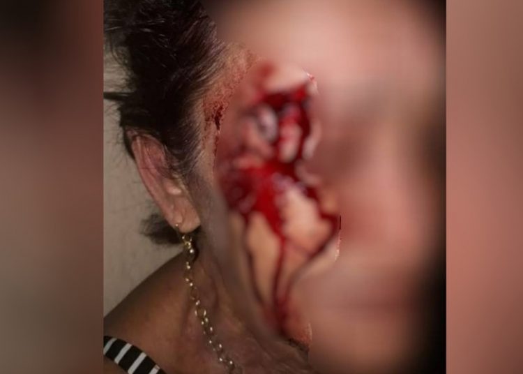 Mulher é ferida na cabeça por companheiro | Foto: Polícia Civil