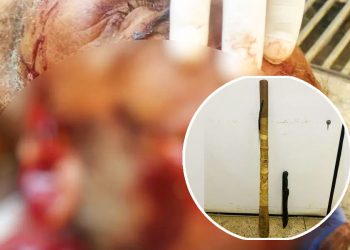 Idoso de 69 anos foi internado após ser espancado no Garavelo, em Aparecida de Goiânia | Foto: Divulgação / PMGO