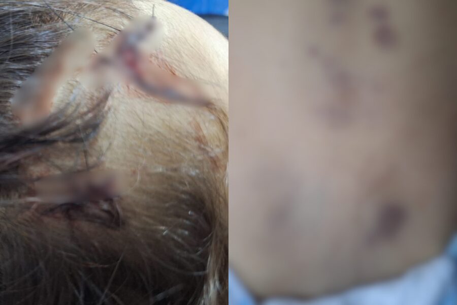 Morte criança 2 anos aparecida de goiânia 