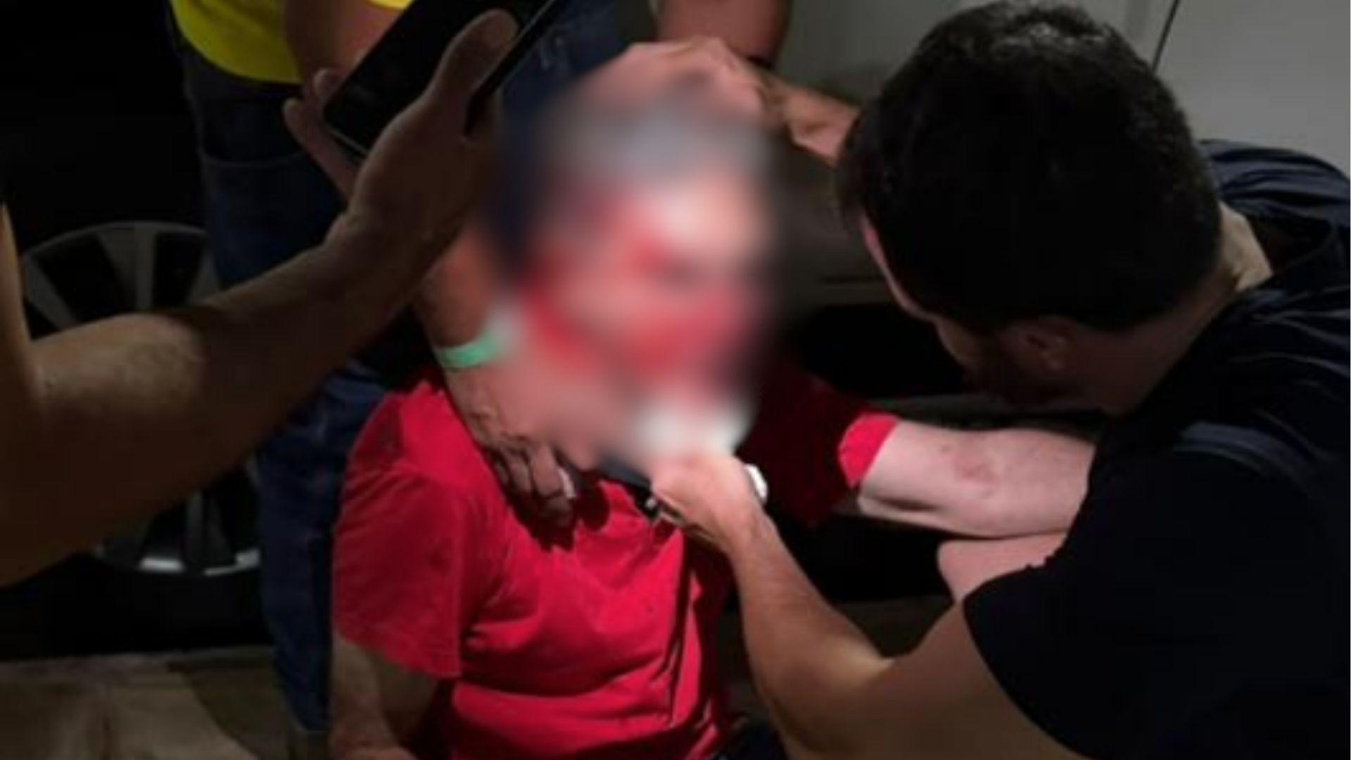 Pastor agredido por usar camiseta vermelha em Goiânia terá que fazer cirurgia
